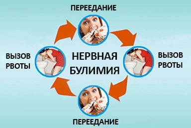 Лечение булимии в Архангельской